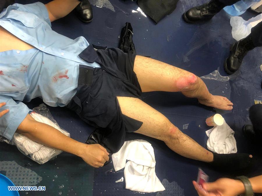 CHINA-HONG KONG-POLICE OFFICER-INJURED